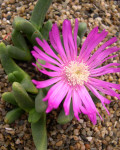 Antegibbaeum